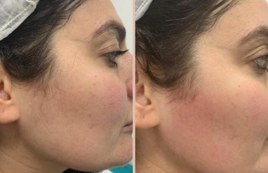 Untitled design 17 2